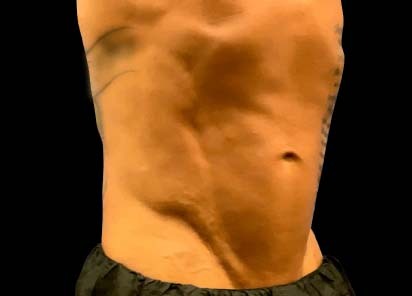Emsculpt_Neo_PIC_123-after-lateral-abdomen-male-JD-McCoy-NMD__412x296px_1663051301_original_New_1713447833_original