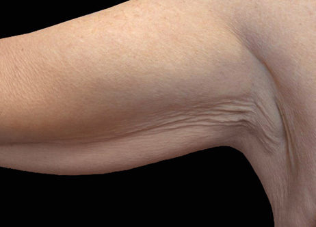 Exion_PIC_Ba-card-arms-female-042_Body_Before_ENUS100_1688740911_original