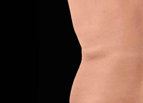 Exion_PIC_Ba-card-back-female-012_Body_After_ENUS100_1688740879_original