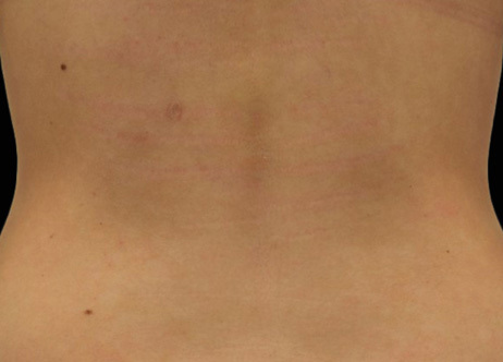 Exion_PIC_Ba-card-back-female-024_FRF_After_ENUS100_1688740587_original