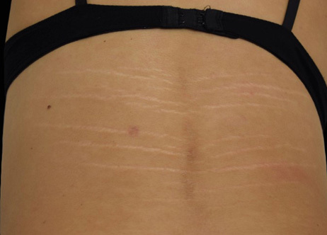 Exion_PIC_Ba-card-back-female-024_FRF_Before_ENUS100_1688740587_original