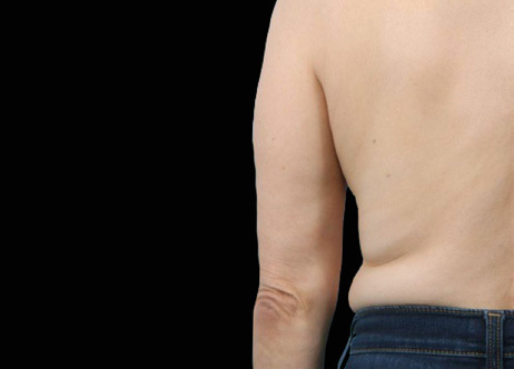 Exion_PIC_Ba-card-back-female-036_Body_After_ENUS100_1688740880_original