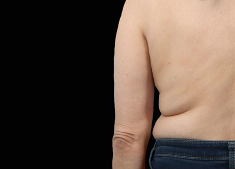 Exion_PIC_Ba-card-back-female-036_Body_Before_ENUS100_1688740879_original