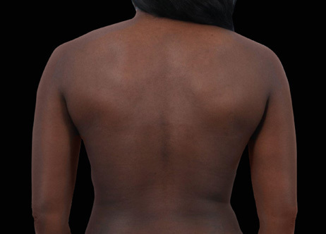 Exion_PIC_Ba-card-back-female-037_Body_After_ENUS100_1688740880_original