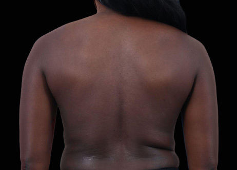 Exion_PIC_Ba-card-back-female-037_Body_Before_ENUS100_1688740880_original