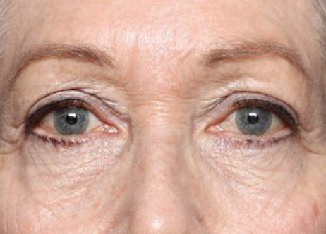 Exion_PIC_Ba-card-eyes-female-009_FRF_After_ENUS100_1688740548_original