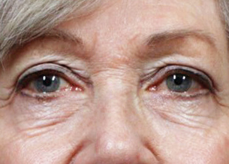 Exion_PIC_Ba-card-eyes-female-009_FRF_Before_ENUS100_1688740548_original