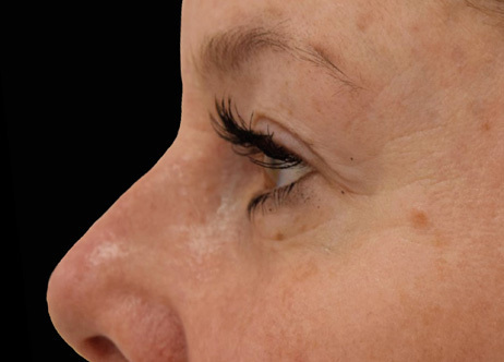 Exion_PIC_Ba-card-eyes-female-011_Face_After_ENUS100_1688740842_original