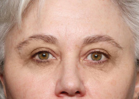 Exion_PIC_Ba-card-eyes-female-014_FRF_After_ENUS100_1688738388_original