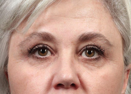 Exion_PIC_Ba-card-eyes-female-014_FRF_Before_ENUS100_1688740550_original