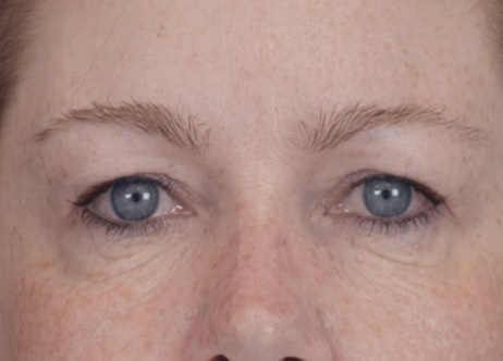 Exion_PIC_Ba-card-eyes-female-026_Face_After_ENUS100_1688740843_original