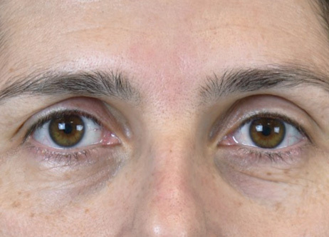 Exion_PIC_Ba-card-eyes-female-039_Face_After_ENUS100_1688740844_original