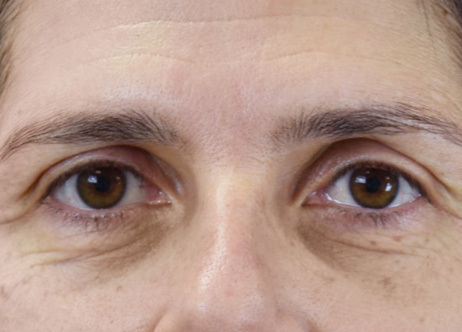 Exion_PIC_Ba-card-eyes-female-039_Face_Before_ENUS100_1688740844_original