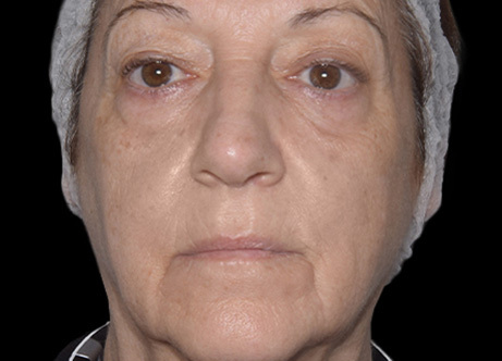 Exion_PIC_Ba-card-face-female-060_Face_After_ENUS100_1688738393_original