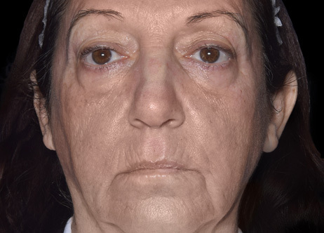 Exion_PIC_Ba-card-face-female-060_Face_Before_ENUS100_1688740845_original