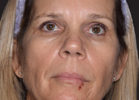 Exion_PIC_Ba-card-face-female-068_FRF_Before_ENUS100_1688738395_original