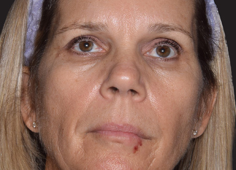 Exion_PIC_Ba-card-face-female-068_FRF_Before_ENUS100_1688740553_original