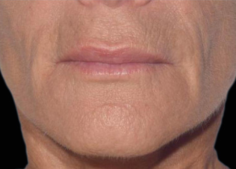 Exion_PIC_Ba-card-mouth-female-066_FRF_After_ENUS100_1688740513_original