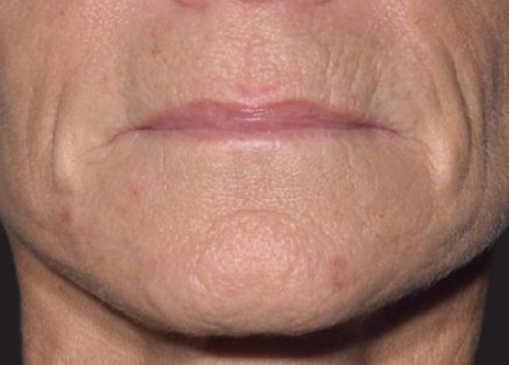 Exion_PIC_Ba-card-mouth-female-066_FRF_Before_ENUS100_1688740513_original