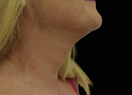 Exion_PIC_Ba-card-neck-female-063_FRF_After_ENUS100_1688740515_original