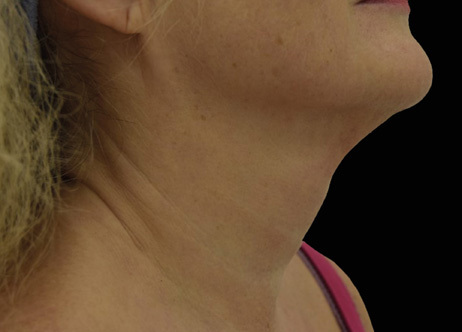 Exion_PIC_Ba-card-neck-female-063_FRF_Before_ENUS100_1688740515_original